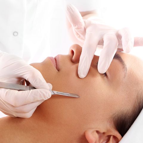 Dermaplaning / Epidermal Leveling - Exquisite Laser Clinic