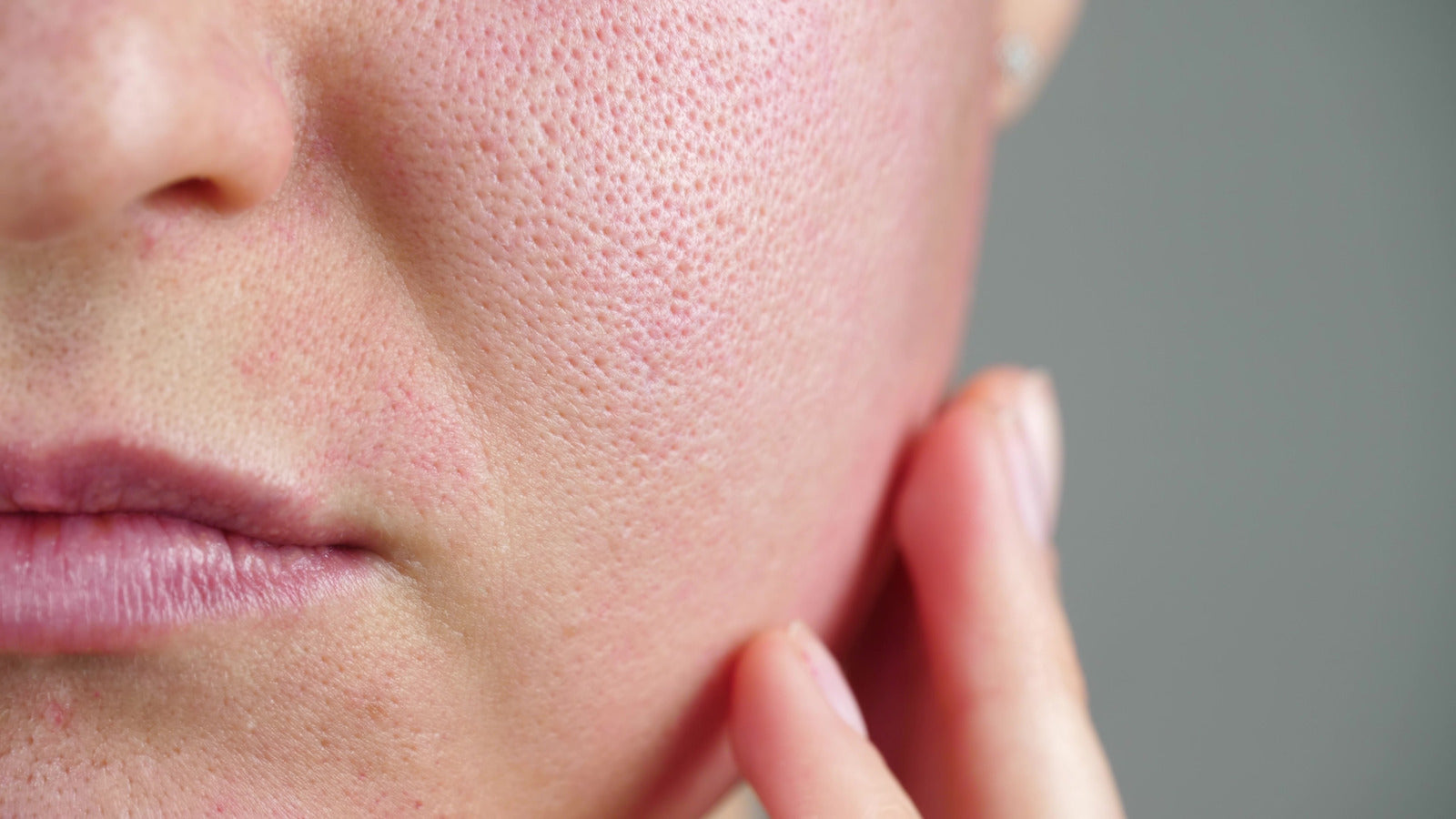 The importance of a healthy skin barrier function