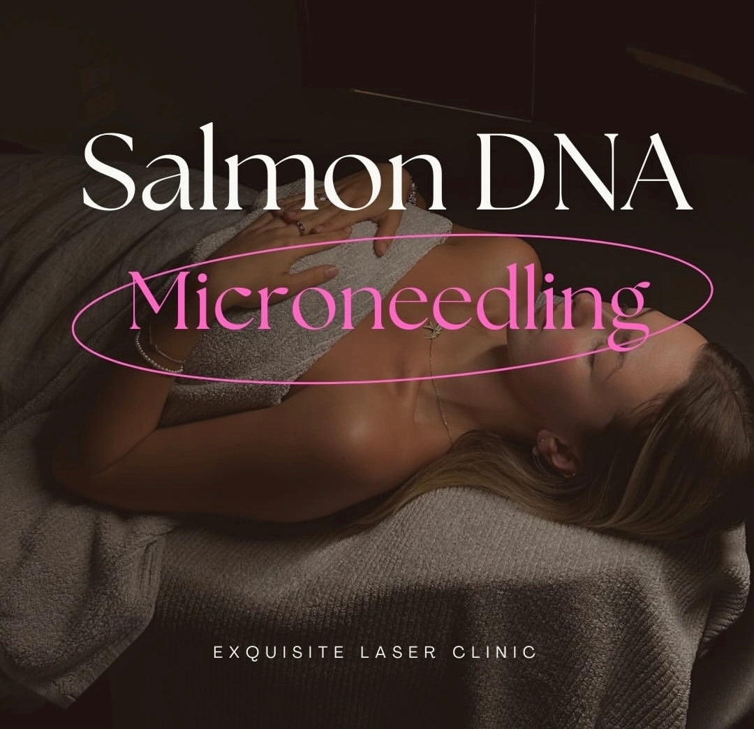 Microneedling Salmon DNA PDRN Treatment Full Face
