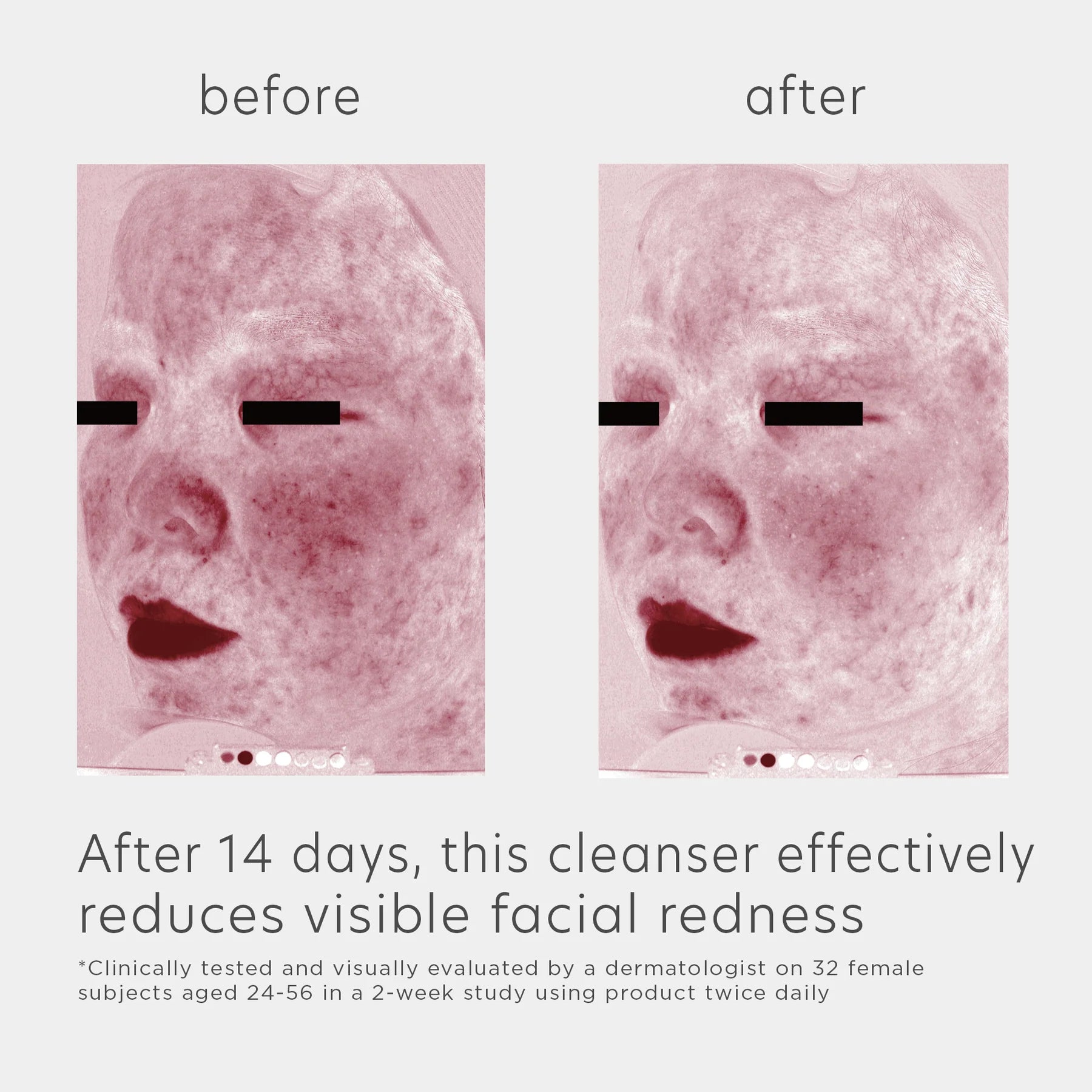 Elta MD cleanser EltaMD Skin Recovery Amino Acid Foaming Cleanser