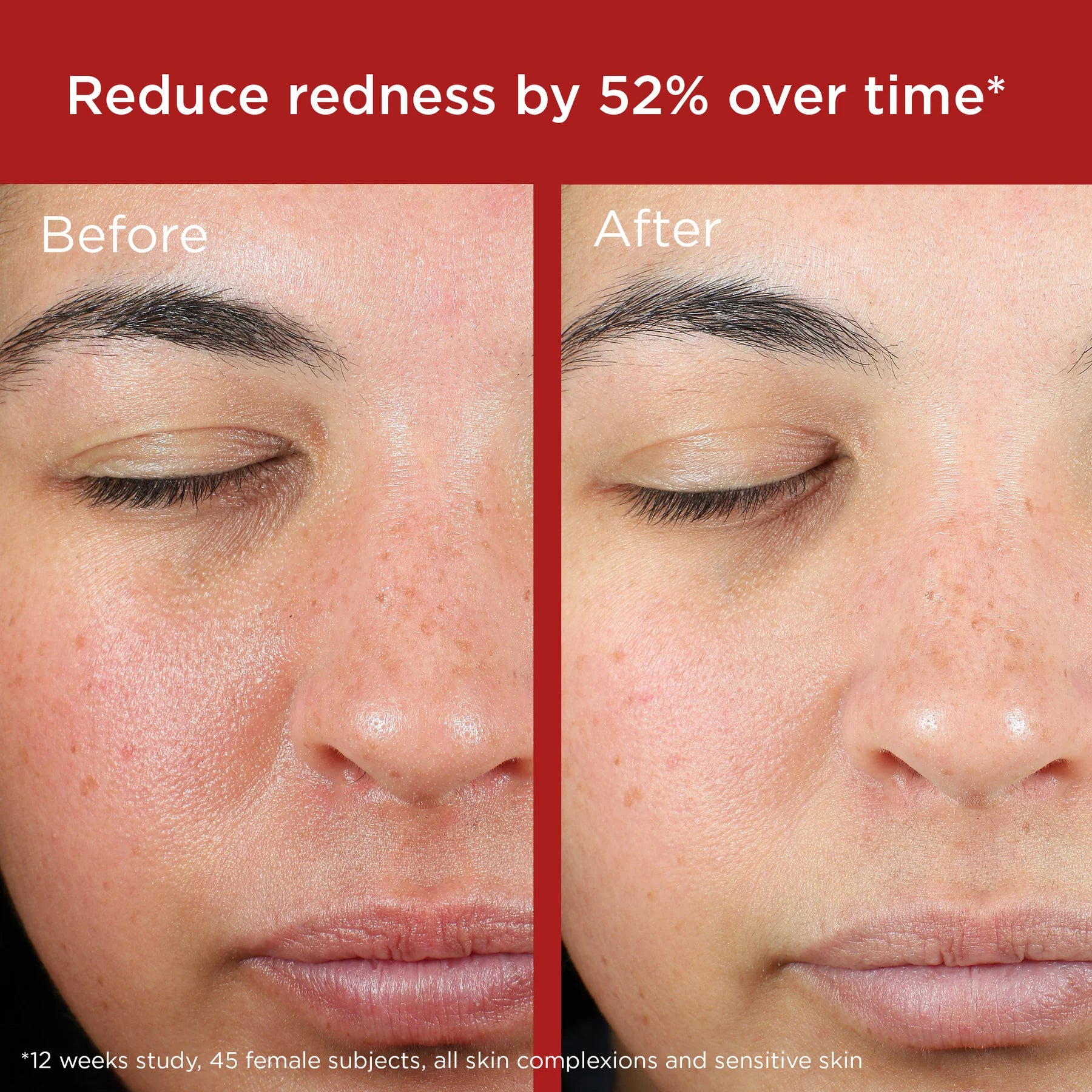 Elta MD sunscreen EltaMD UV Skin Recovery Broad Spectrum SPF 50 Face Sunscreen - Untinted