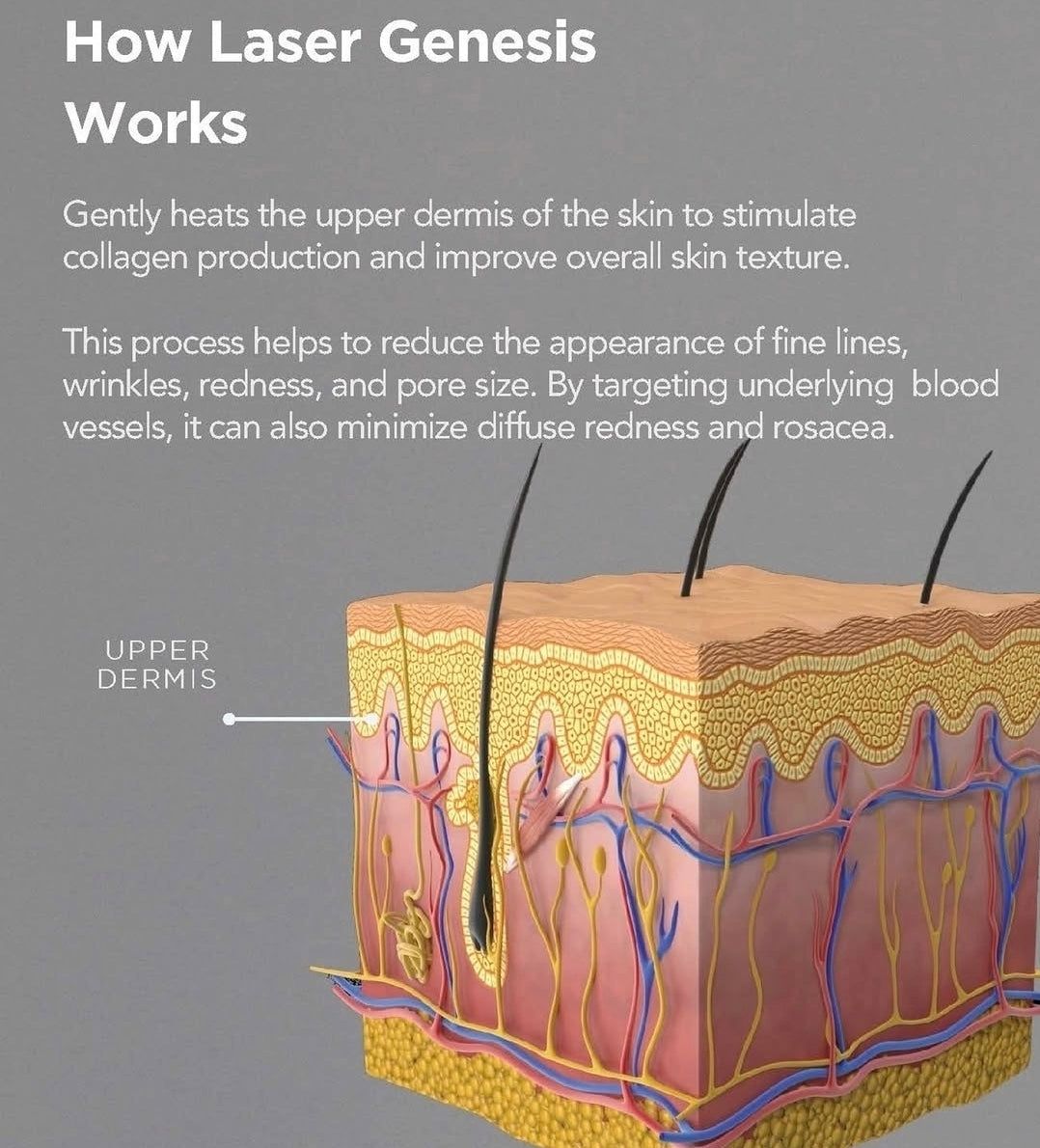 Exquisite Laser Clinic  skin treatment Laser Genesis Skin Rejuvenation Full Face