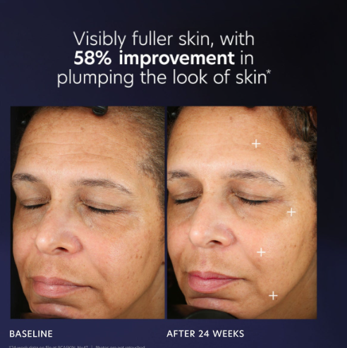 PCA Pro Max Age Renewal - Exquisite Laser Clinic 