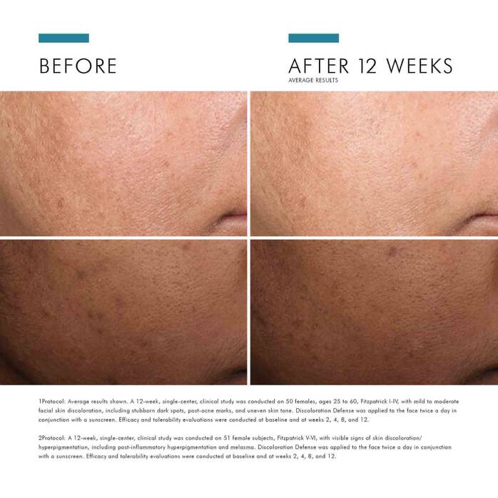 skinceuticals skincare Skinceuticals Discoloration Defense **Pre Order**