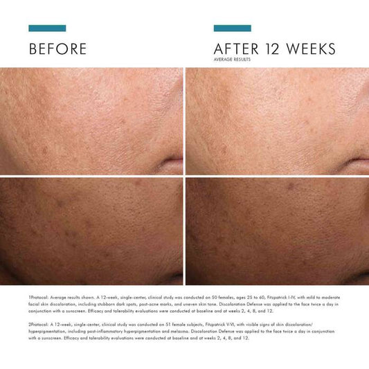 skinceuticals skincare Skinceuticals Discoloration Defense **Pre Order**
