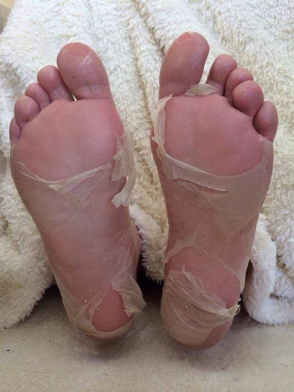 Probeauty skincare Foot Peel