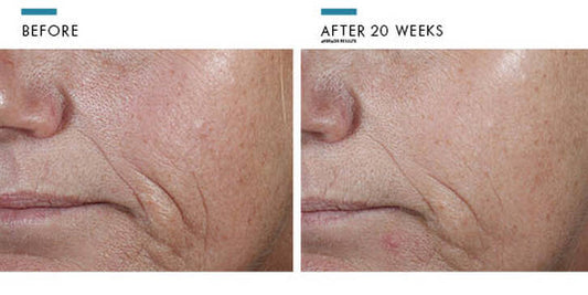 SKINCEUTICALS CE FERULIC 30ml - Exquisite Laser Clinic