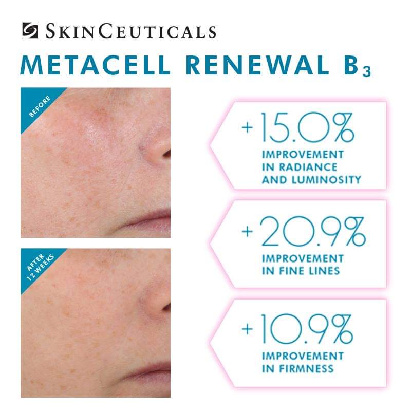 skinceuticals skincare Skinceuticals Metacell Renewal B3